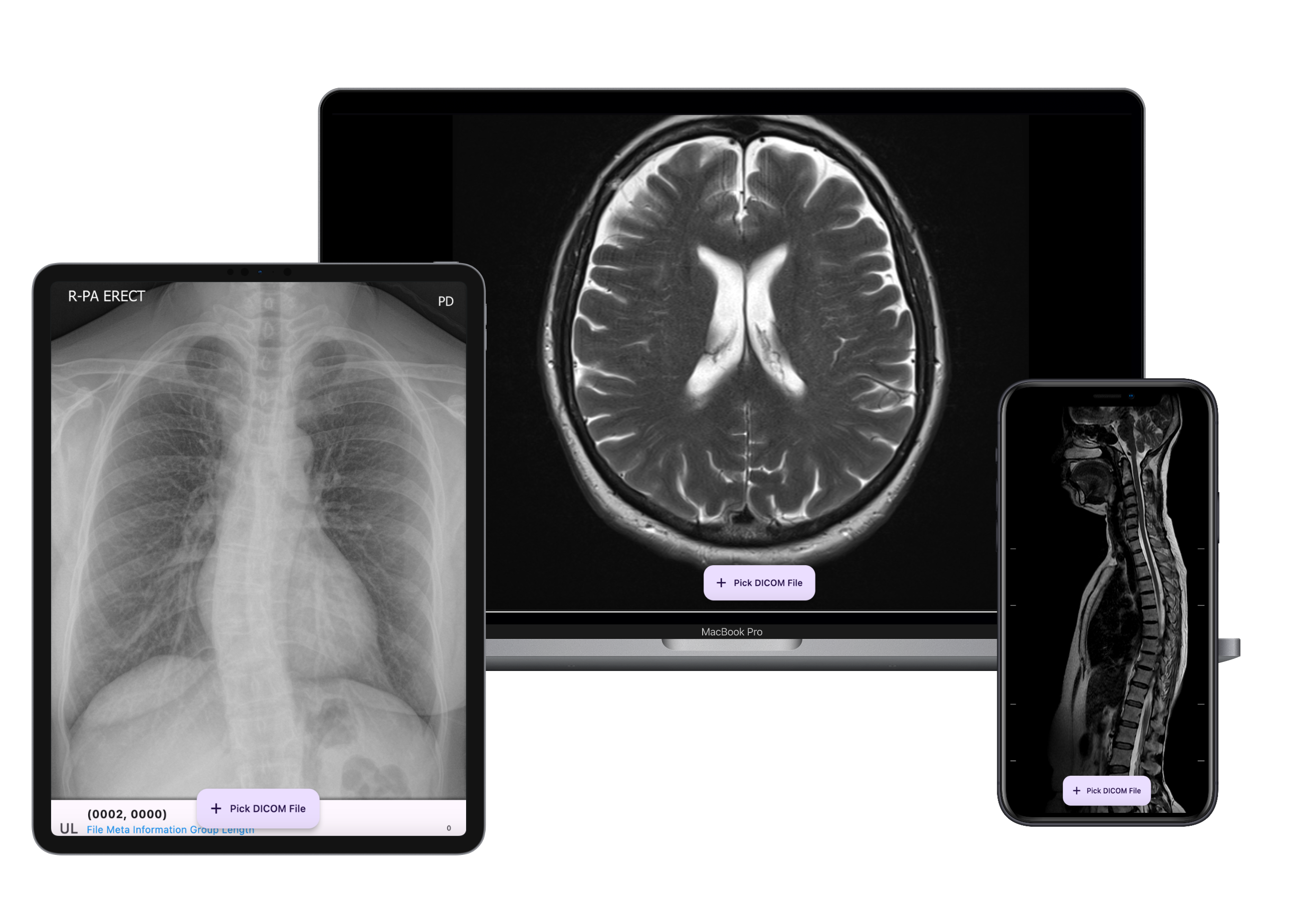 Dicom parser Flutter Package